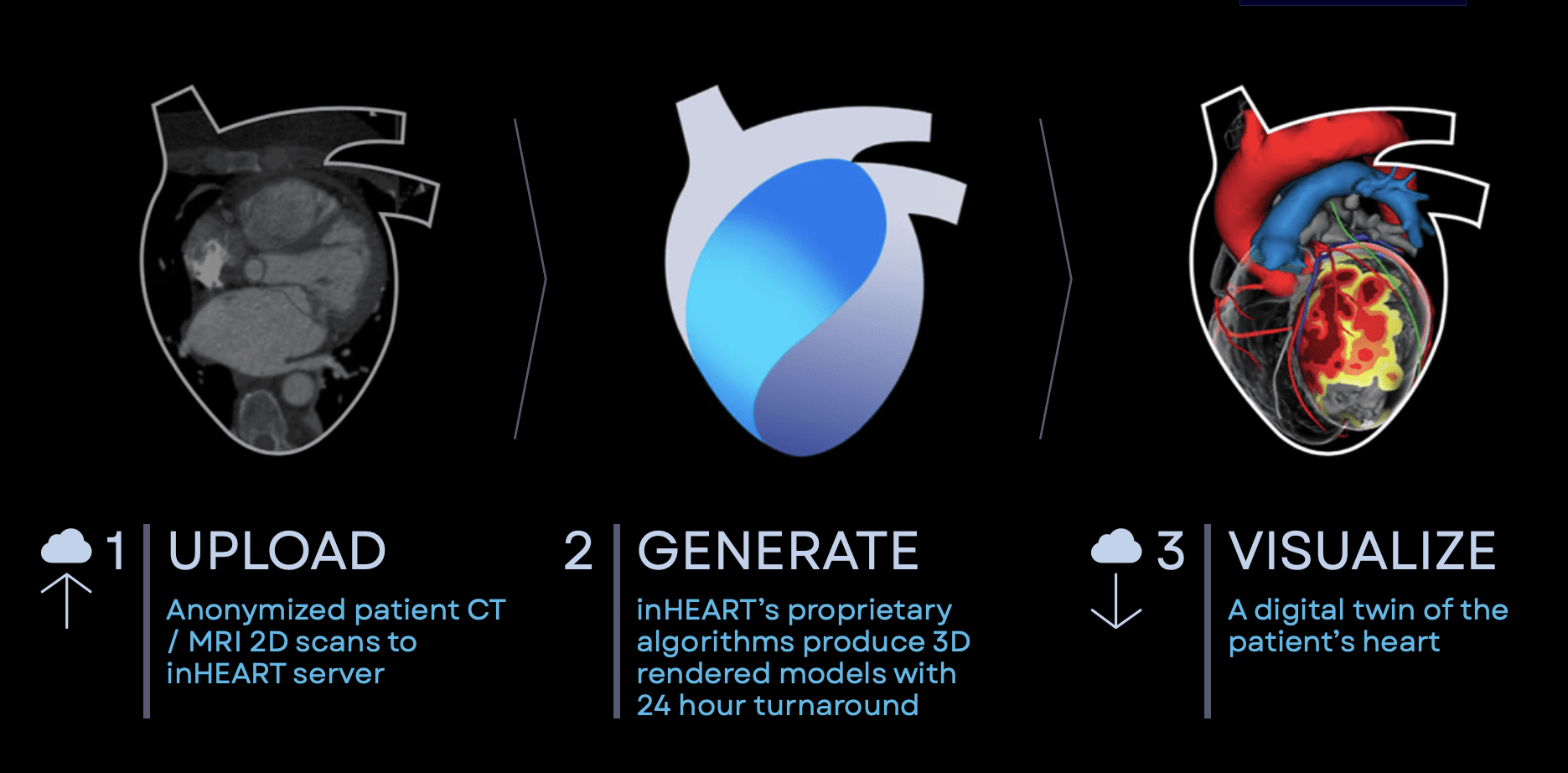 Three-step procedural diagram of inHEART digital twin cardiac technology